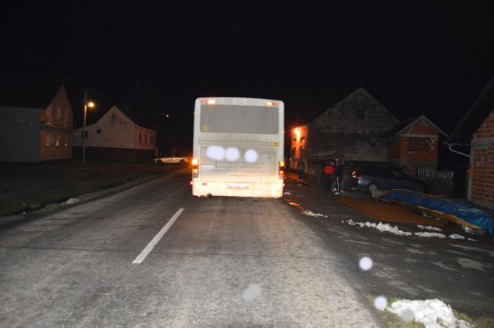 Nepažljivi vozač kotačem autobusa prešao ženskoj osobi preko noge