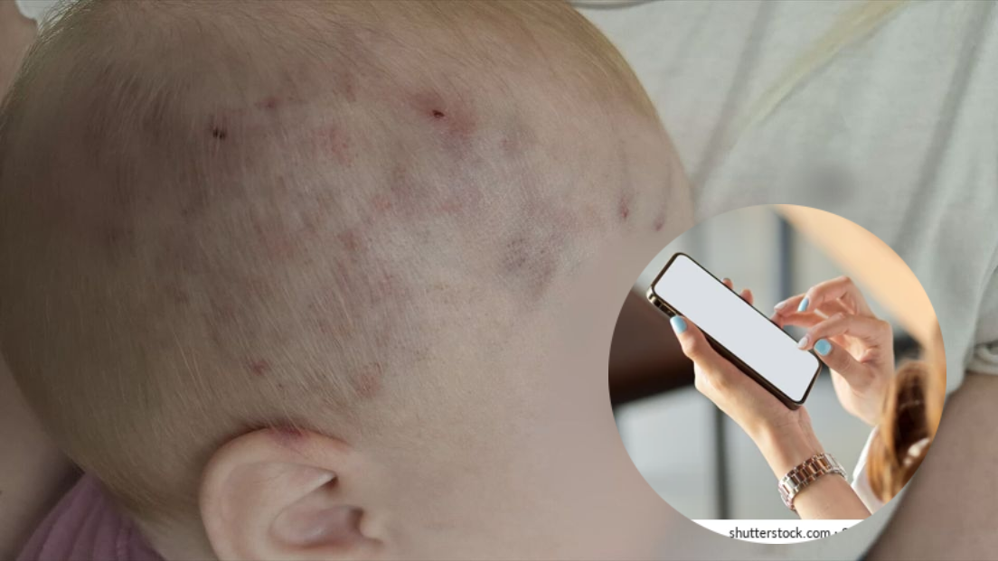 DOKUMENTI OTKRIVAJU ISTINU: Odgojiteljice nisu primijetile ozlijeđeno dijete jer su bile na mobitelima?!
